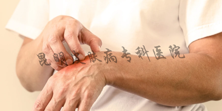 疤痕病昆明治疗专科